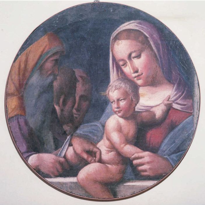 circoncisione